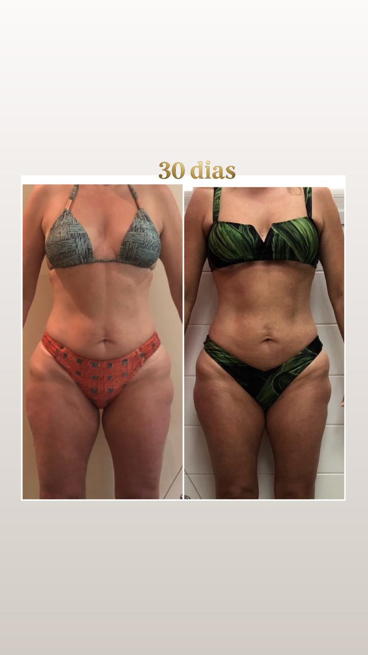 Antes e depois - emagrecimento com acompanhamento profissional SP